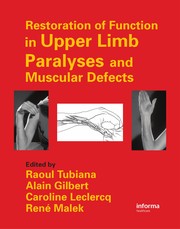 Restoration of function in upper limb paralyses and muscular defects
