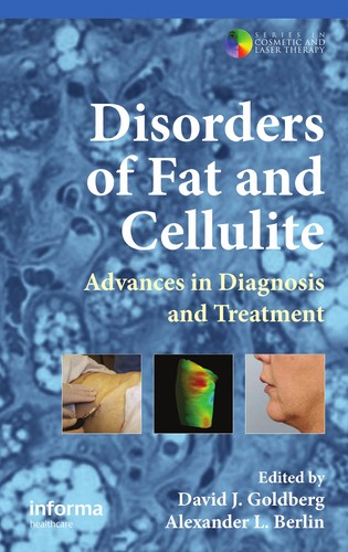 Disorders of fat and cellulite