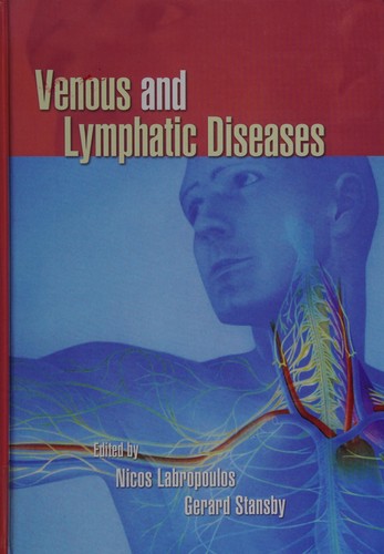 Venous and lymphatic diseases