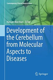 Development of the Cerebellum from Molecular Aspects to Diseases