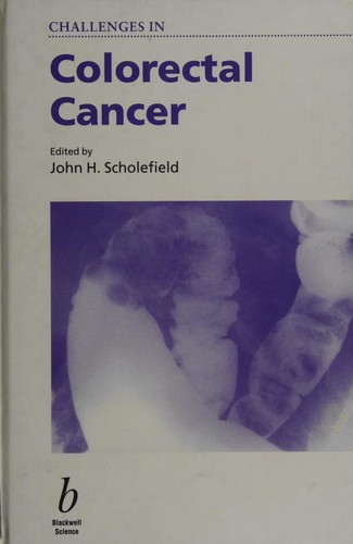 Challenges in Colorectal Cancer (Challenges in)