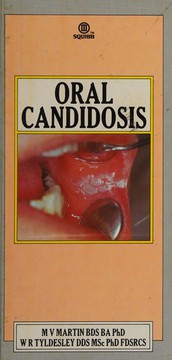 Oral candidosis