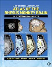 A combined MRI and histology atlas of the rhesus monkey brain in stereotaxic coordinates