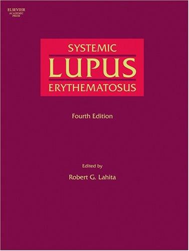 Systemic Lupus Erythematosus