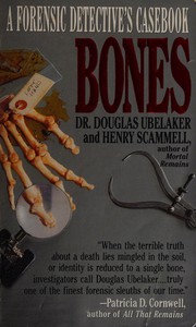 Bones