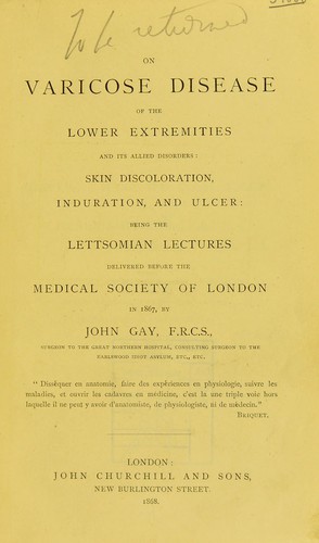 On varicose disease of the lower extremities and its allied disorders