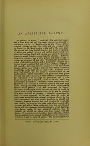 An artificial larynx