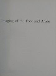 Imaging of the foot and ankle