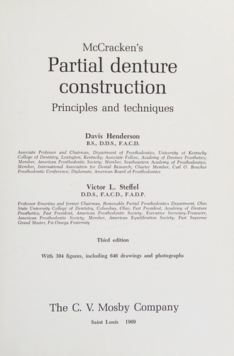 Partial denture construction