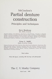 Partial denture construction