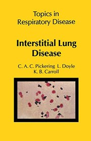 Interstitial lung disease