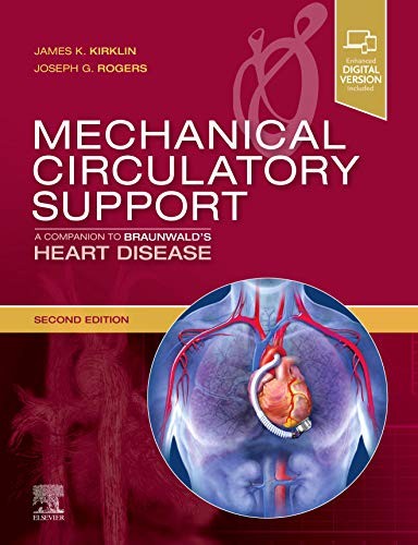 Mechanical circulatory support