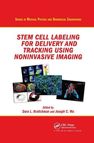 Stem cell labeling for delivery and tracking using noninvasive imaging