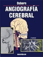 Angiografia Cerebral