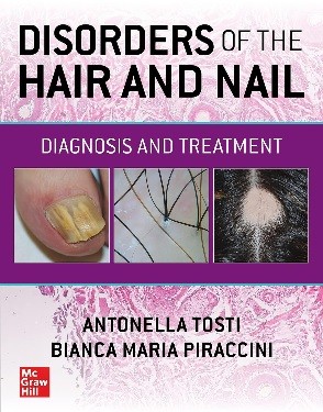 Disorders of the Hair and Nail