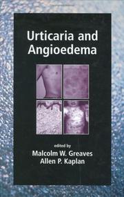 Urticaria and angioedema