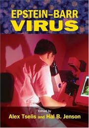 Epstein-Barr virus