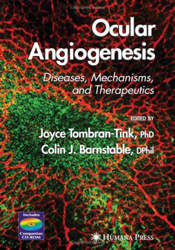 Ocular angiogenesis