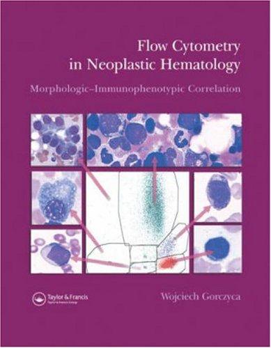 Flow Cytometry in Neoplastic Hematology