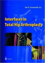Interfaces in Total Hip Arthroplasty