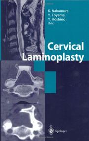 Cervical laminoplasty