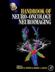 Handbook of neuro-oncology neuroimaging