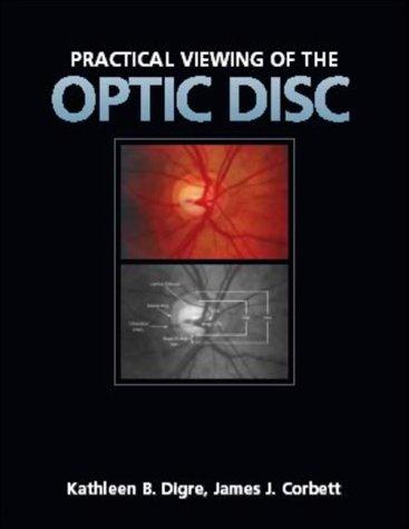 Practical viewing of the optic disc