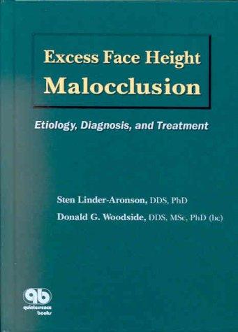 Excess Face Height Malocclusion