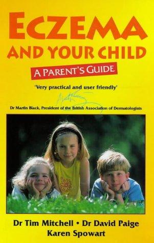 Eczema and your child
