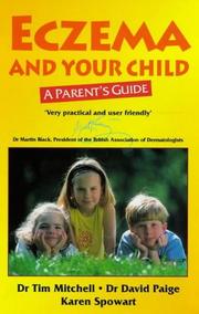 Eczema and your child