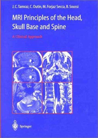 MRI principles of the head, skull base, and spine