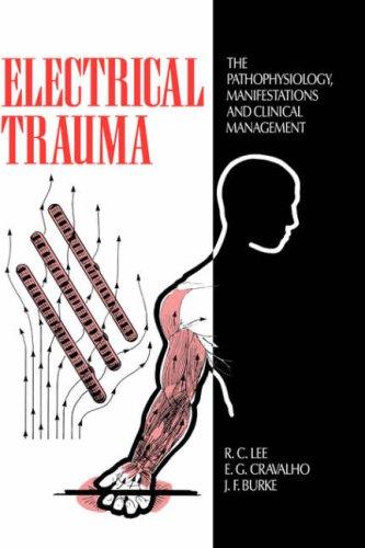 Electrical trauma