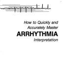 How to quickly and accurately master arrhythmia interpretation