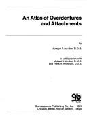 An atlas of overdentures and attachments
