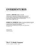 Overdentures