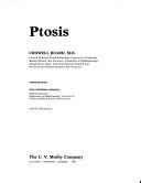 Ptosis