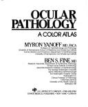 Ocular pathology