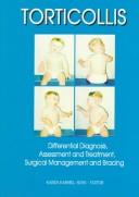 Torticollis