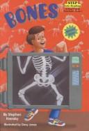 Bones