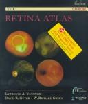Retina Atlas