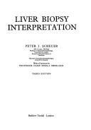 Liver biopsy interpretation