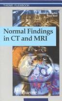 Normal Findings in CT and MRI