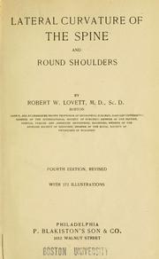Lateral curvature of the spine and round shoulders