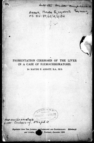 Pigmentation cirrhosis of the liver in a case of hæmochromatosis