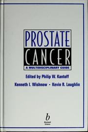Prostate cancer