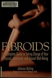 Fibroids