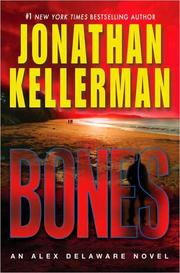 Bones