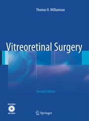 Vitreoretinal Surgery