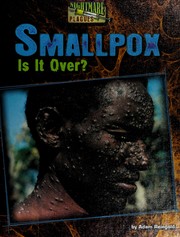 Smallpox